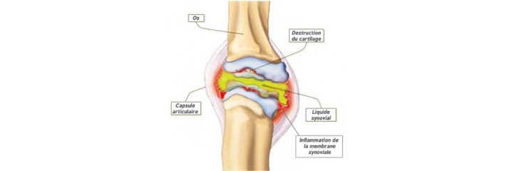 Articulations - Douleurs - Muscles