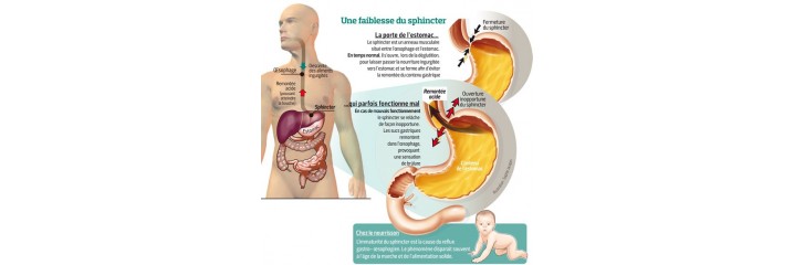 ACIDITE GASTRIQUE ET REFLUX